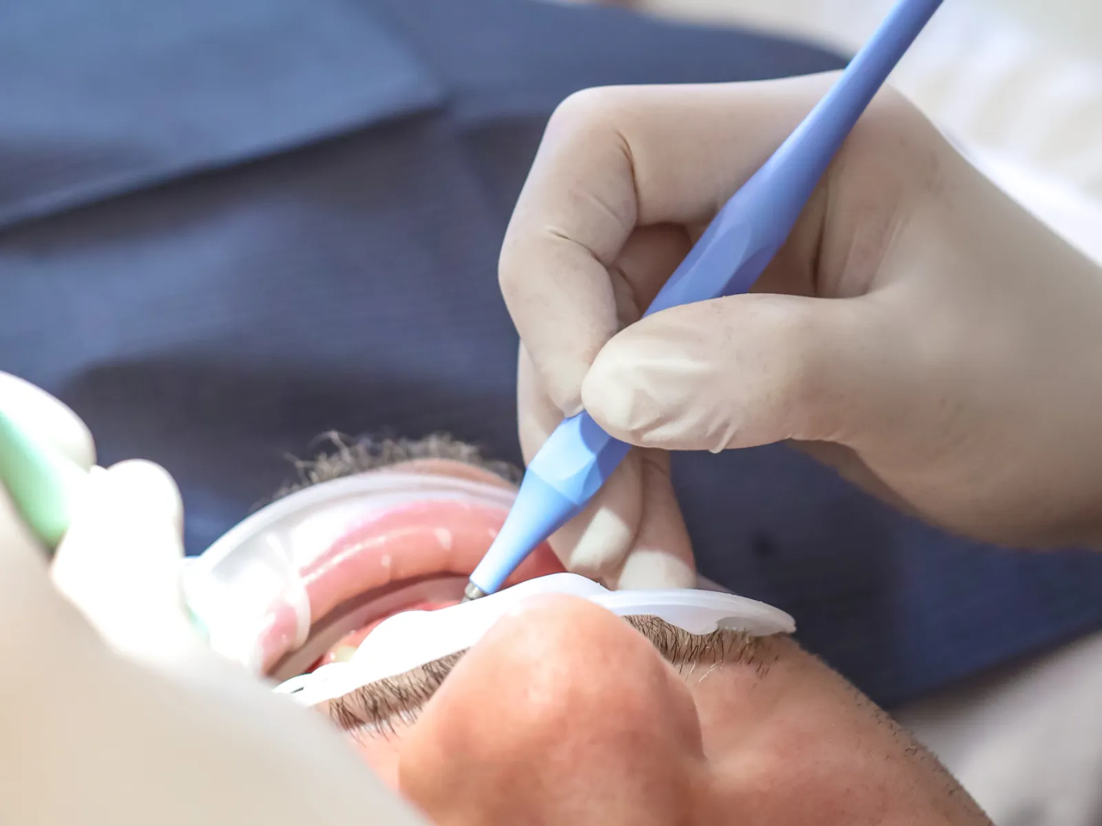 Implantáty v ambulancii ADRILEX Trenčín